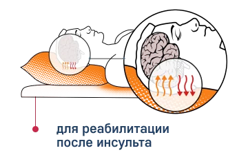 Мягкие модули НПОТПЗ